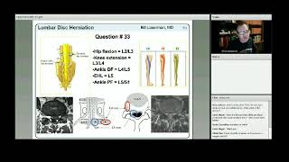 SPINE WEBINAR Miller/ Orthobullets review Webinars