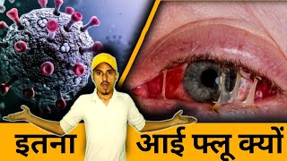 Eye Flu: क्यों होता है आई फ्लू, जानें लक्षण और बचाव के तरीके | Eye Flu Kya Hota Hai