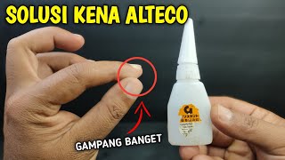 Ternyata Semudah ini, Cara Melepaskan Kulit Jari Kena ALTECO Lem G Super Glue