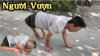 người đàn ông 44 năm đi bằng đầu gối bò như VƯỢN