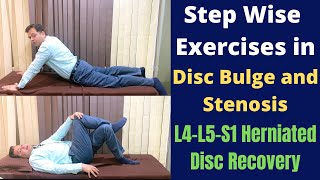 Exercises For Herniated Disc, Disc Bulge L4-L5-S1, Step Wise Treatment for Slipped Disc Recovery