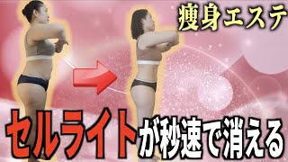 本当に痩せる痩身エステビフォーアフター。食べる量を増やしてセルライト解消！12kgダイエット成功。バーの女性オーナーの体験談。