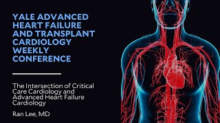 The Intersection of Critical Care Cardiology and Advanced Heart Failure Cardiology