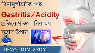 বিনামূলীয়াকৈ গেছ/Gastritis/Acidity প্ৰতিৰোধ কৰা বা ভাল কৰাৰ উপায় #devottom #devottomaxom #assam