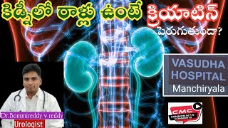 urology in Vasudha super speciality Hospital వసుధ ఆసుపత్రిలో కిడ్నీ మూత్ర సంబంధ వ్యాధుల వివరణ