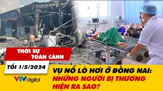 Thời sự toàn cảnh tối 1/5: Vụ nổ lò hơi ở Đồng Nai: Những người bị thương hiện ra sao? | VTV24