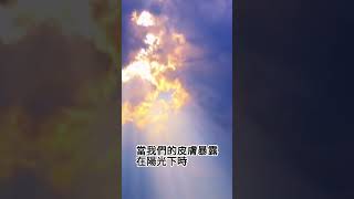 秋冬抗流感 系列 維生素D 3-  陽光的優勢