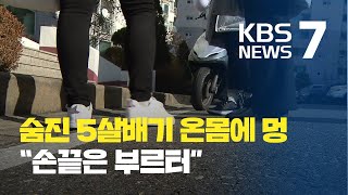 5살 딸이 온몸에 멍…아동학대치사 혐의 엄마 체포 / KBS뉴스(News)