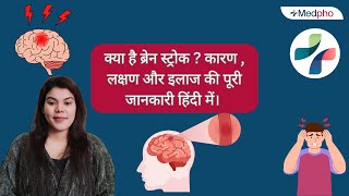 स्ट्रोक क्या है? कारण, लक्षण और इलाज की पूरी जानकारी |