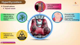 Hyperthyroidism Part 2 : Etiology, Types, Clinical manifestations, Diagnosis and Treatment