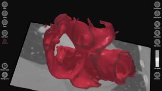 3D Cardiac Review: A Medical Modeling App