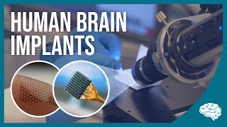 Behind the Brain Chip: An Inside Look at Blackrock Neurotech