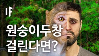 만약에 여러분이 원숭이두창 걸린다면? [한국어 더빙] | 만약에 What If Korea