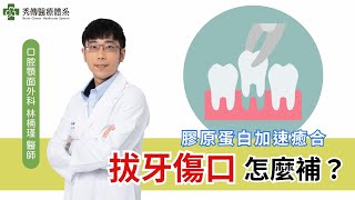 膠原蛋白對拔牙的好處！