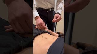 Acupuncture can be VERY *Relaxing*