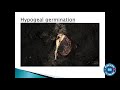 epigeal and hypogeal germination epicotyl and hypocotyl germination