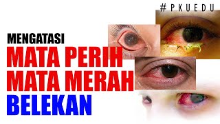 Mengatasi Mata Merah | #PKUEDU