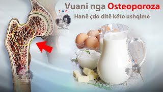 Po vuani nga osteoporoza dhe kane dhimbje kockash duhet të hanë çdo ditë këto ushqime