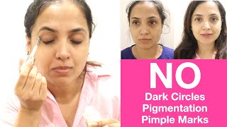 ಬಂಗು \u0026 ಡಾರ್ಕ್ ಸರ್ಕಲ್ಸ್ ಗೆ ಸಿಂಪಲ್ ಪರಿಹಾರ | Eye Serum To Reduce Dark Circles \u0026 Pigmentation