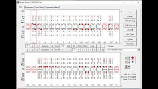 Eaglesoft - Patient Perio Chart