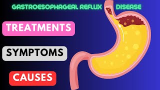 Gastroesophageal Reflux Disease (GERD): Symptoms, Causes, and Treatments