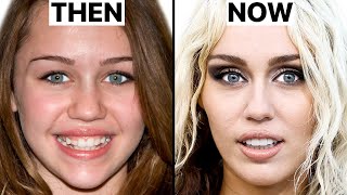 What Happened to Miley Cyrus' Face? | Plastic Surgery Analysis