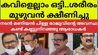 അതികഠിനമായ ചികിത്സ.. രാജുവിന്റെ ഇപ്പോഴത്തെ അവസ്ഥ കണ്ടോ? actor maniyan pilla raju health issue news