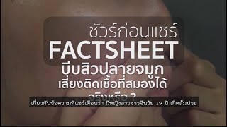 ชัวร์ก่อนแชร์ : บีบสิวปลายจมูกเสี่ยงติดเชื้อในสมอง จริงหรือ ?