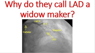 Why do they call LAD a widow maker?