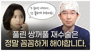 [풀린 눈 재수술 2편] 풀리는 이유와 해결 방법! | 눈성형만 하는 온리아이성형외과