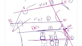 01-Basic,Points,planes (Cephalometric analysis ).