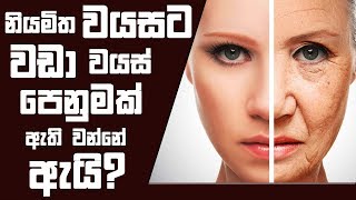 නියමිත වයසට වඩා වයස් පෙනුමක් ඇති වන්නේ ඇයි? | 11 - 07 - 2018