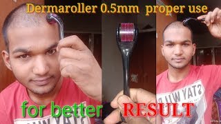 How to use derma roller system 0.5mm proper for better result।Sonu Kumar Mishra। #dermarollersystem