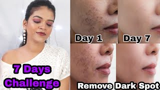 7 दिवसात Skin Clear कशी करावी | Acne, Pimples, Pigmentation, Dark Spot कसे कमी करावे | Pranita Parab