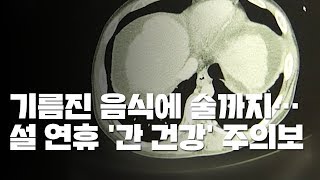 기름진 음식에 술까지...설 연휴 '간 건강' 주의보 / YTN