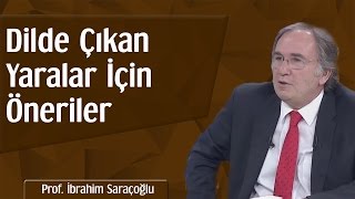 Dilde Çıkan Yaralar İçin Öneriler | Prof. İbrahim Saraçoğlu