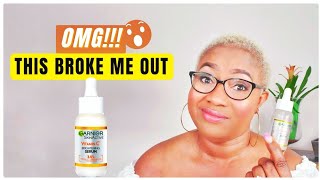 GARNIER VITAMIN C SERUM .ESTHETICIAN HONEST REVIEW| 4 WEEKS RESULTS