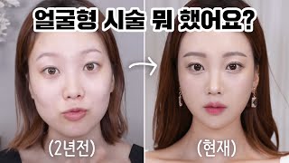 Facial shape treatment management summary ‼️ How to make your face look pretty(home skincare)