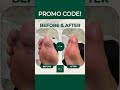 viral exfoliation solutions for thick feet skin u0026 calluses at home instant foot peel bestways