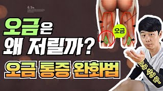 오금통증 원인과 해결방법 | 물리치료사 PT 재석