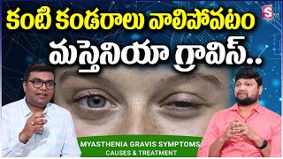 Myasthenia Gravis | RENOVA HOSPATAL | కంటి కండరాలు వాలిపోవటం, శాశ్వత చికిత్స | Dr MuraLIDHAR