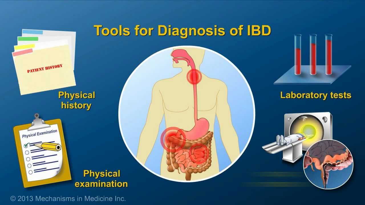 Diagnosing IBD - YouTube