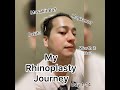 My Rhinoplasty Surgery from Day 1-14 ( 2 Weeks Post Op)