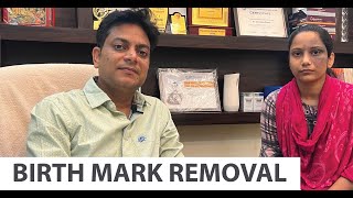 Birthmark Removal I Laser Birthmark Removal I Co2 Laser Birthmark Removal | Rejuvena Cosmo Care |