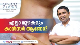 എല്ലാ മുഴകളും കാൻസർ ആണോ?