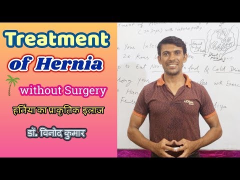 Treatment of Hernia without Surgery | Hindi Treatment of Hernia without Surgery | Hindi