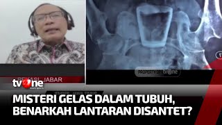 Fenomena Gelas Kaca di dalam Perut Pria Viral, Ada Campur Tangan Mistis? | AKIP tvOne