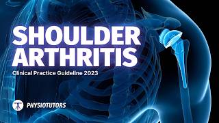 Glenohumeral Osteoarthritis Guideline Review 2023