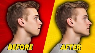 Improve Face Side Profile | Jawline