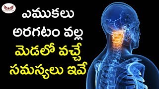 ఎముకలు అరగటం వల్ల మేడలో వచ్చే సమస్యలు ఇవే.!head